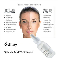 The Ordinary -   Niacinamide 10% + Zinc 1% - 30ml - Beauty by Daraz