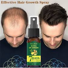 7 Days Hair Growth Germinal Serum Oil Natural Hair Treatment Effective Fast Growth Hair Care 30ML